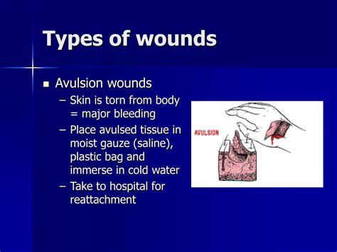 types of puncture wounds